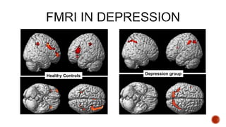 Depression groupHealthy Controls
 