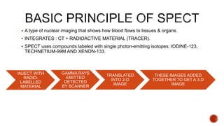  A type of nuclear imaging that shows how blood flows to tissues & organs.
 INTEGRATES : CT + RADIOACTIVE MATERIAL (TRACER).
 SPECT uses compounds labeled with single photon-emitting isotopes: IODINE-123,
TECHNETIUM-99M AND XENON-133.
INJECT WITH
RADIO-
LABELLED
MATERIAL
GAMMA RAYS
EMITTED
DETECTED
BY SCANNER
TRANSLATED
INTO 2-D
IMAGE
THESE IMAGES ADDED
TOGETHER TO GET A 3-D
IMAGE
 