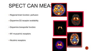  Regional brain function: perfusion
 Dopamine D2 receptor availability
 Dopamine transporter function
 M1 muscarinic receptors
 Nicotinic receptors
 