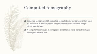 Computed tomography
 Computed tomography (CT, also called computed axial tomography or CAT scan)
is a procedure in which a precise x-ray beam takes cross-sectional images
(slices) layer by layer.
 A computer reconstructs the images on a monitor and also stores the images
on magnetic tape or ﬁlm
 