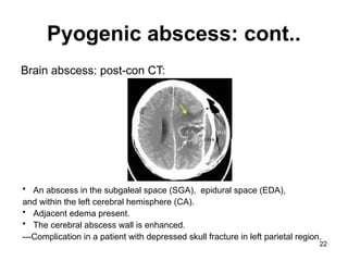 Brain Infection Part -1, presentation123 | PPTX