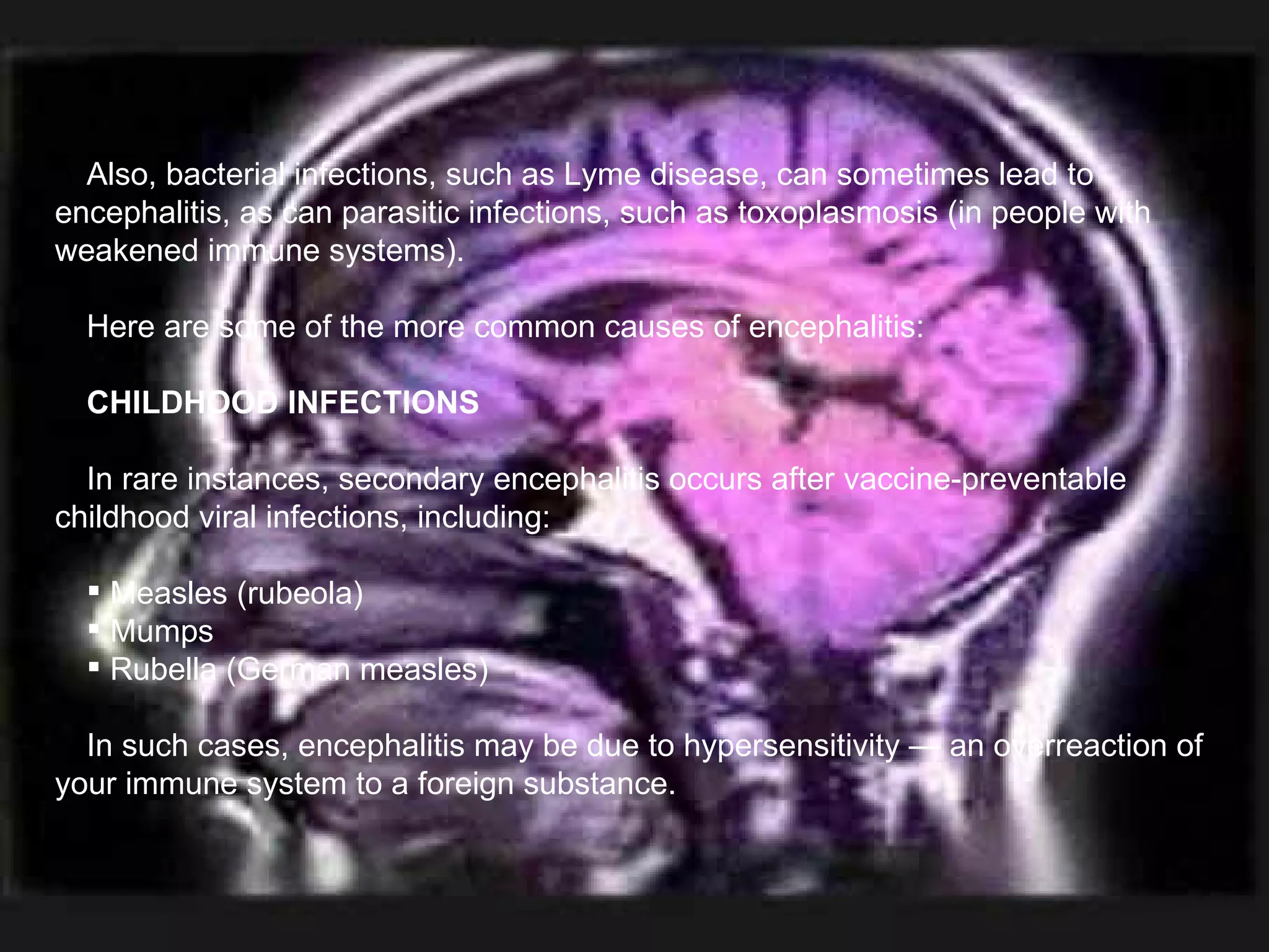 Also, bacterial infections, such as Lyme disease, can sometimes lead to encephalitis, as can parasitic infections, such as toxoplasmosis (in people with weakened immune systems). Here are some of the more common causes of encephalitis: CHILDHOOD INFECTIONS In rare instances, secondary encephalitis occurs after vaccine-preventable childhood viral infections, including: Measles (rubeola) Mumps Rubella (German measles) In such cases, encephalitis may be due to hypersensitivity — an overreaction of your immune system to a foreign substance. 