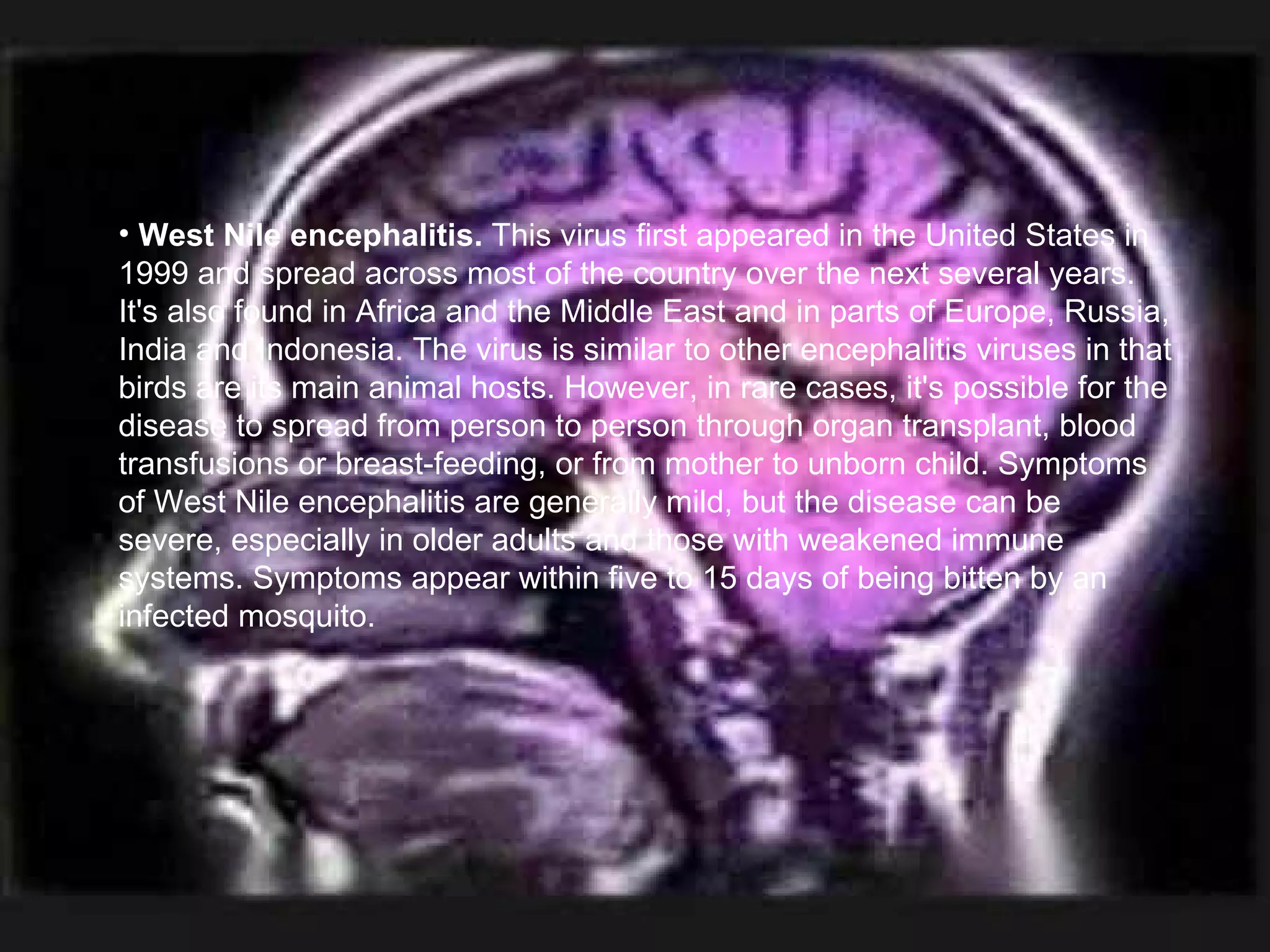 West Nile encephalitis.  This virus first appeared in the United States in 1999 and spread across most of the country over the next several years. It's also found in Africa and the Middle East and in parts of Europe, Russia, India and Indonesia. The virus is similar to other encephalitis viruses in that birds are its main animal hosts. However, in rare cases, it's possible for the disease to spread from person to person through organ transplant, blood transfusions or breast-feeding, or from mother to unborn child. Symptoms of West Nile encephalitis are generally mild, but the disease can be severe, especially in older adults and those with weakened immune systems. Symptoms appear within five to 15 days of being bitten by an infected mosquito.  