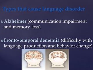 Alzheimer (communication impairment
and memory loss)
Fronto-temporal dementia (difficulty with
language production and behavior change)
Types that cause language disorder
 