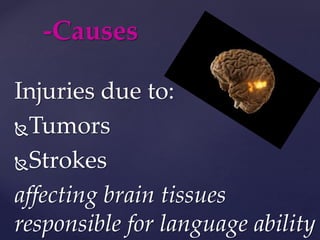 Injuries due to:
Tumors
Strokes
affecting brain tissues
responsible for language ability
-Causes
 