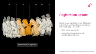 Intraoperative Cone Beam Computed Tomography | PDF