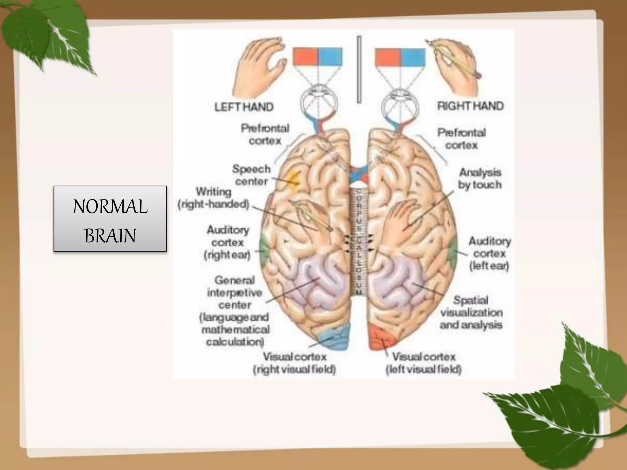 Brain lateralization | PPTX