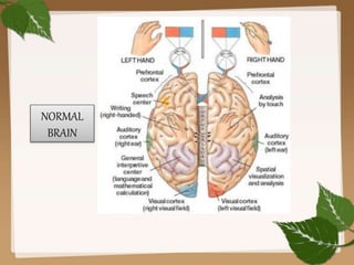NORMAL
BRAIN
 