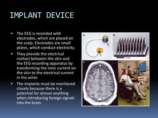 Brain Machine Interface | PPTX