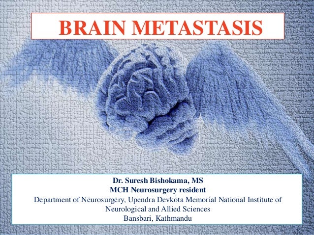 checkmate 9la brain metastases checkmate 9la brain metastases