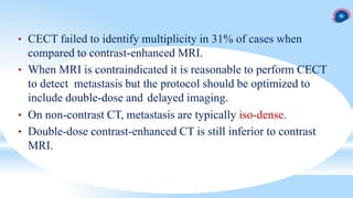 Brain metastasis ppt by DR. AFIA.pptx