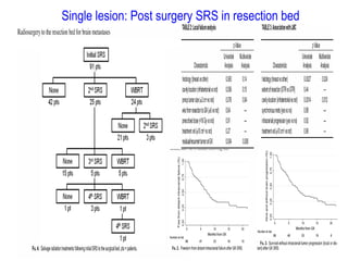 Single lesion: Post surgery SRS in resection bed
 