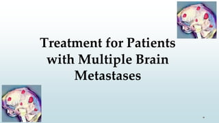 Treatment for Patients
with Multiple Brain
Metastases
 