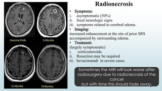 Radionecrosis
• Symptoms:
i. asymptomatic (50%)
ii. focal neurologic signs
iii. symptoms related to cerebral edema.
• Imaging:
increased enhancement at the site of prior SRS
accompanied by surrounding edema.
• Treatment:
(largely symptomatic)
i. corticosteroids.
ii. Resection may be required
iii. bevacizumab in severe cases.
Sometimes the MRI will look worse after
radiosurgery due to radionecrosis of the
cancer
but with time this should fade away.
 