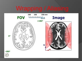 BRAIN MRI 2016MENGAPA PERLU MRI PADA JARINGAN OTAK.ppt