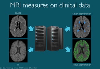 Brain MRI biomarkers for improved follow up of people with Multiple ...