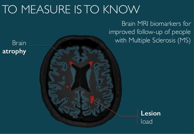 brain mri biomarkers for improved follow up of people with multiple s