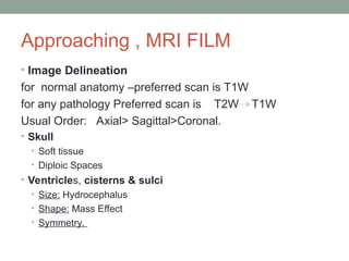 Approaching , MRI FILM
• Image Delineation
for normal anatomy –preferred scan is T1W
for any pathology Preferred scan is T2W T1W
Usual Order: Axial> Sagittal>Coronal.
• Skull
• Soft tissue
• Diploic Spaces
• Ventricles, cisterns & sulci
• Size: Hydrocephalus
• Shape: Mass Effect
• Symmetry.
 