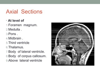 Axial Sections
• At level of
1.Foramen magnum.
2.Medulla .
3.Pons .
4.Midbrain .
5.Third ventricle
6.Thalamus.
7.Body of lateral ventricle.
8.Body of corpus callosum.
9.Above lateral ventricle
 
