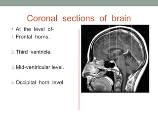 Coronal sections of brain
 At the level of-
1. Frontal horns.
2. Third ventricle.
3. Mid-ventricular level.
4. Occipital horn level
 