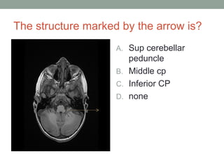 The structure marked by the arrow is?
A. Sup cerebellar
peduncle
B. Middle cp
C. Inferior CP
D. none
 