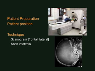 Normal Scanogram Brain_normal.ppt