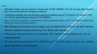 Brain perfusion nuclear medicine