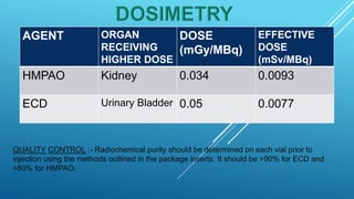 Brain perfusion nuclear medicine