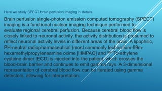 Brain perfusion nuclear medicine
