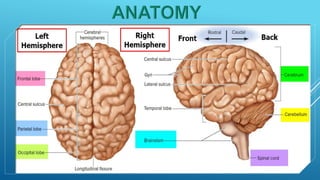 Brain perfusion nuclear medicine