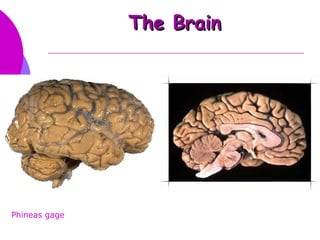 The Brain




Phineas gage
 