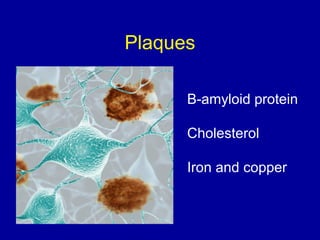 Plaques
Β-amyloid protein
Cholesterol
Iron and copper
 