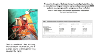 Brain Protection Management – (in Aortic Arch.pptx