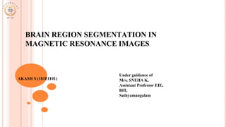 BRAIN REGION SEGMENTATION IN
MAGNETIC RESONANCE IMAGES
AKASH S (181EI101)
Under guidance of
Mrs. SNEHA K,
Assistant Professor EIE,
BIT,
Sathyamangalam
 