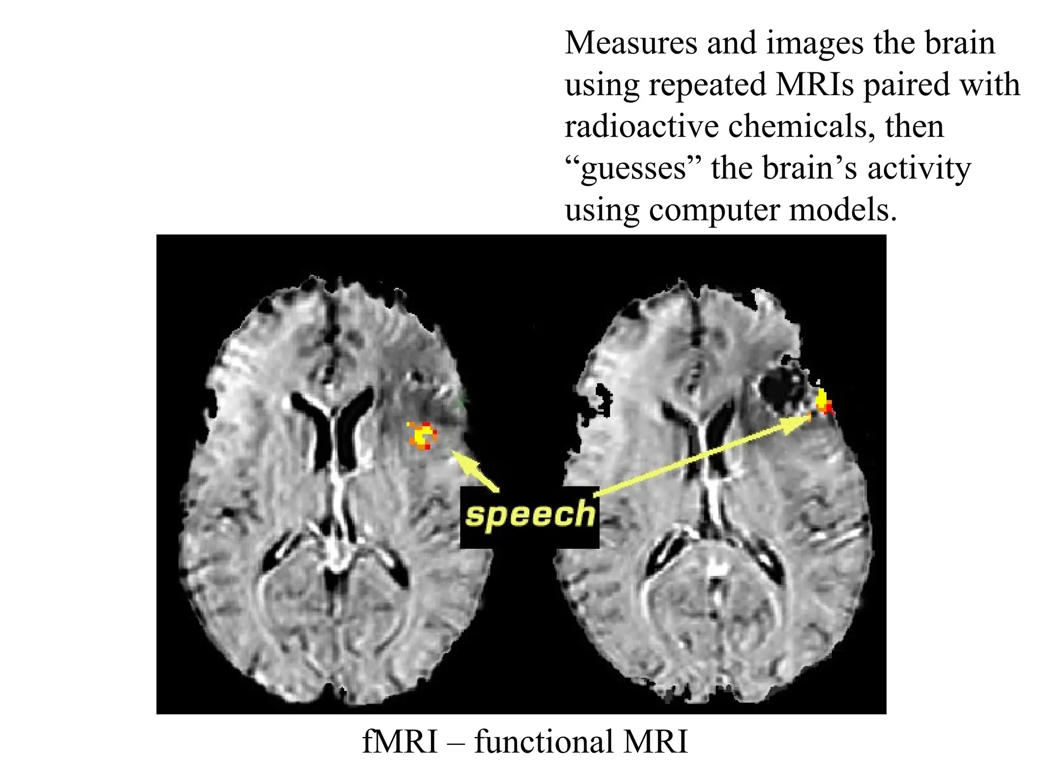 fMRI – functional MRI
Measures and images the brain
using repeated MRIs paired with
radioactive chemicals, then
“guesses” the brain’s activity
using computer models.
 