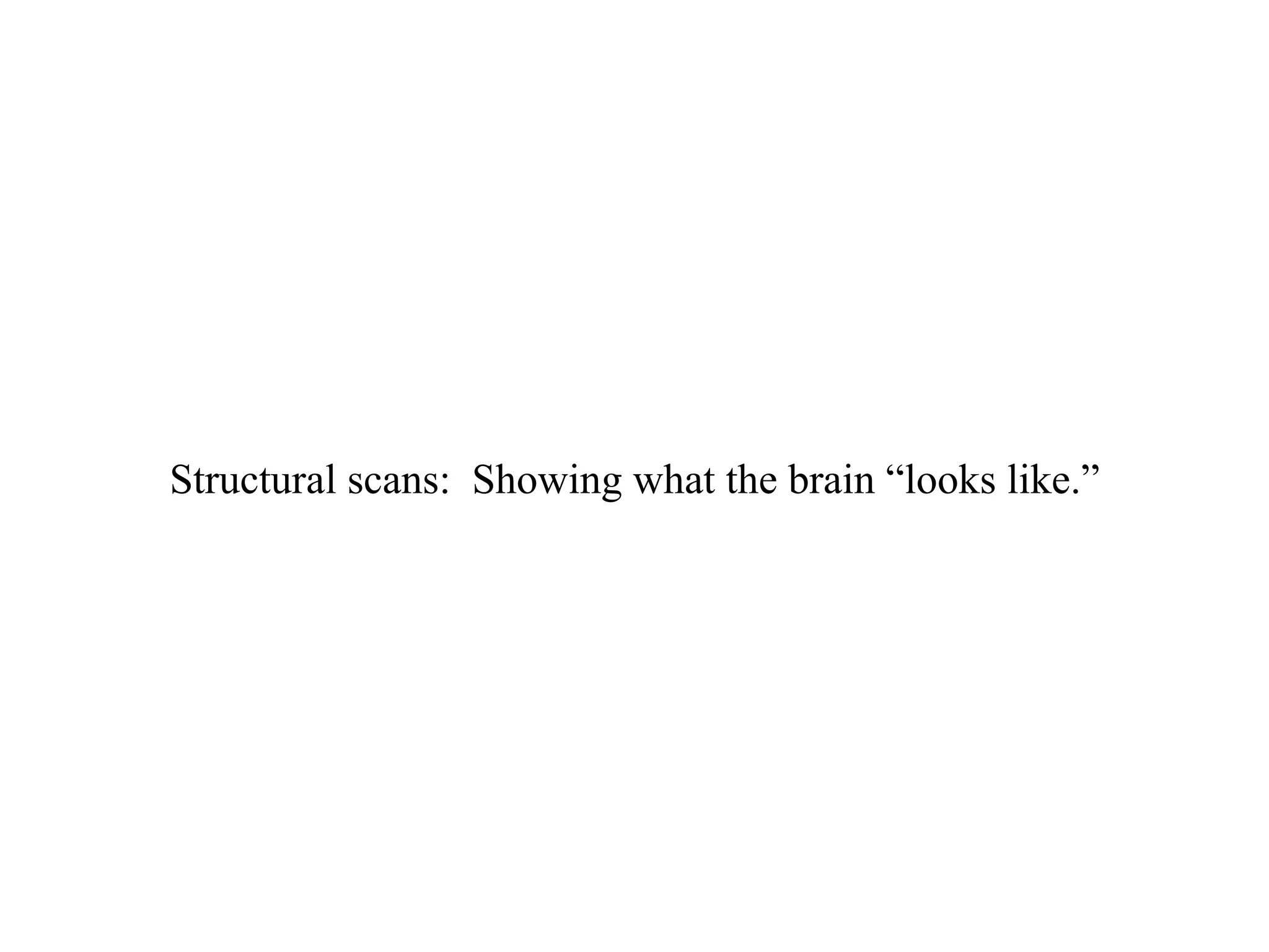 Structural scans: Showing what the brain “looks like.”
 