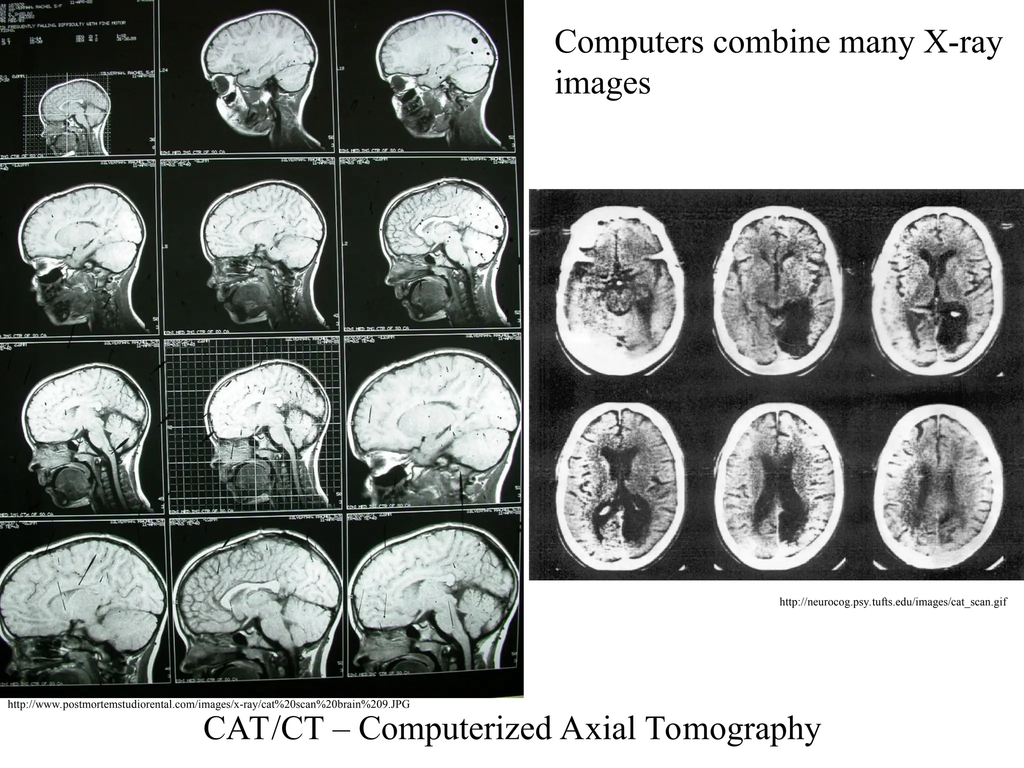 CAT/CT – Computerized Axial Tomography
http://www.postmortemstudiorental.com/images/x-ray/cat%20scan%20brain%209.JPG
http://neurocog.psy.tufts.edu/images/cat_scan.gif
Computers combine many X-ray
images
 