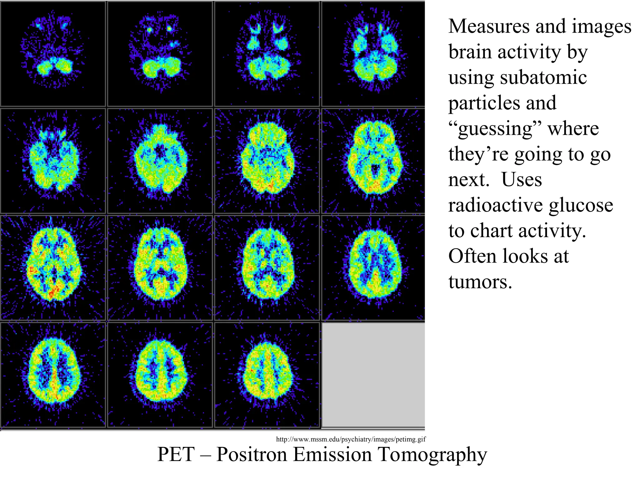 PET – Positron Emission Tomography
Measures and images
brain activity by
using subatomic
particles and
“guessing” where
they’re going to go
next. Uses
radioactive glucose
to chart activity.
Often looks at
tumors.
http://www.mssm.edu/psychiatry/images/petimg.gif
 
