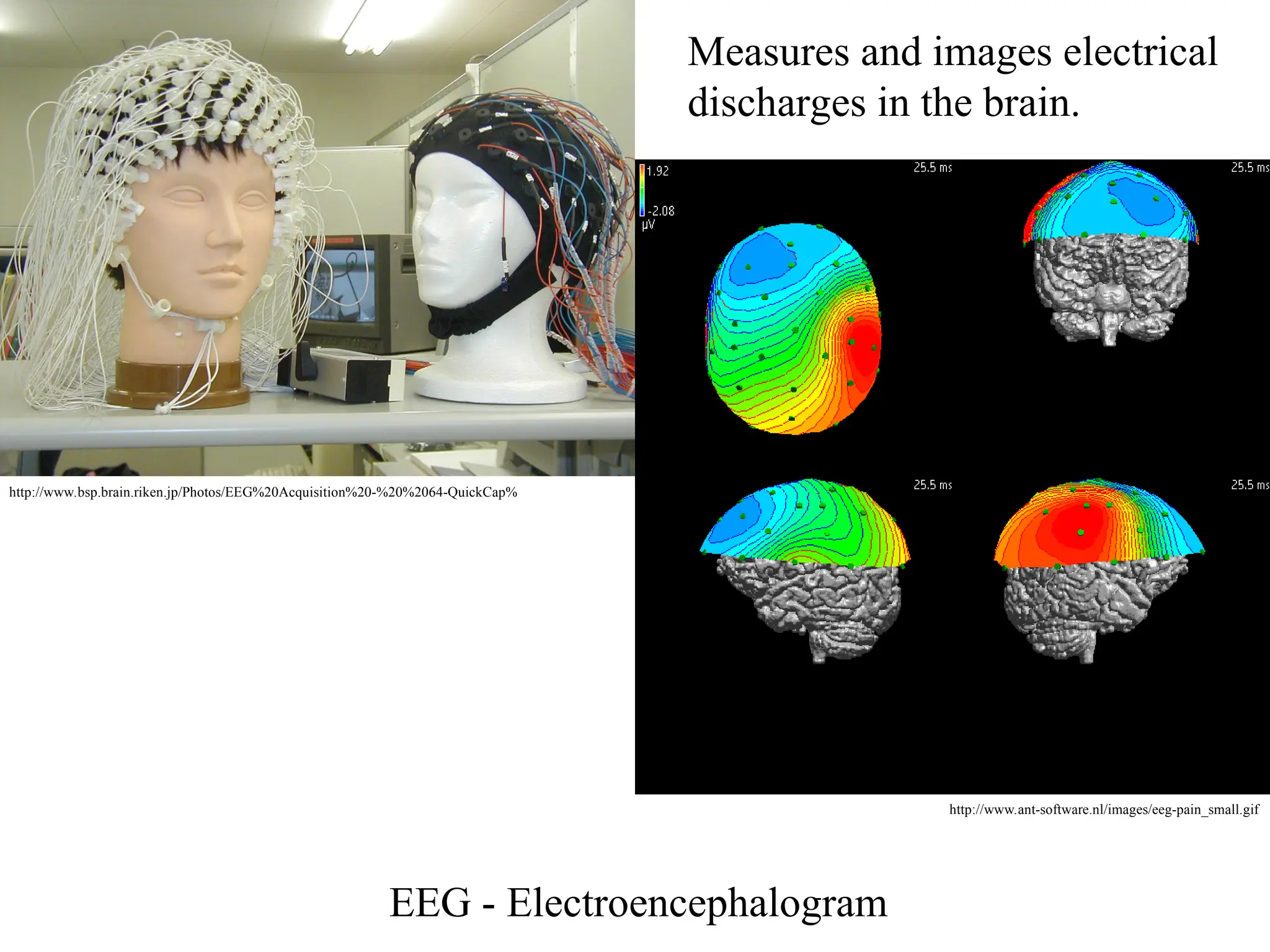 EEG - Electroencephalogram
Measures and images electrical
discharges in the brain.
http://www.bsp.brain.riken.jp/Photos/EEG%20Acquisition%20-%20%2064-QuickCap%
http://www.ant-software.nl/images/eeg-pain_small.gif
 