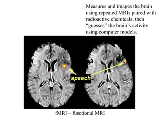 fMRI – functional MRI
Measures and images the brain
using repeated MRIs paired with
radioactive chemicals, then
“guesses” the brain’s activity
using computer models.
 