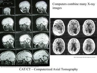 CAT/CT – Computerized Axial Tomography
http://www.postmortemstudiorental.com/images/x-ray/cat%20scan%20brain%209.JPG
http://neurocog.psy.tufts.edu/images/cat_scan.gif
Computers combine many X-ray
images
 