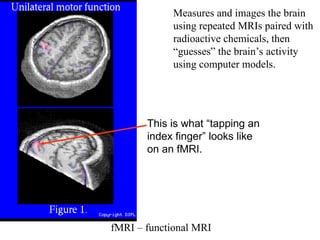 fMRI – functional MRI
Measures and images the brain
using repeated MRIs paired with
radioactive chemicals, then
“guesses” the brain’s activity
using computer models.
This is what “tapping an
index finger” looks like
on an fMRI.
 