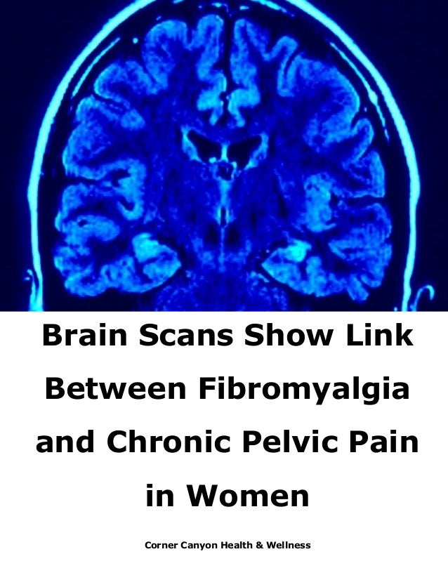 Scans Show Possible Link Between Brain >> Brain Scans Show Link Between Fibromyalgia And Chronic Pelvic Pain In Scans Show Possible Link Between Brain >> Brain Scans Show Link Between Fibromyalgia And Chronic Pelvic Pain In