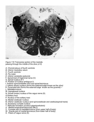 Figure 116 Transverse section of the medulla
passing through the middle of the olive (x12)
A. Choroid plexus of fourth ventricle
B. Inferior medullary velum
C. Fourth ventricle
D. Pia mater
E. Inferior cerebellar peduncle
F. Spinal tract of trigeminal nerve (V)
G. Spinal nucleus of V
H. Position of nucleus ambiguus U
I. Anterior spinocerebellar tract and spinal lemniscus
J. Inferior olivary nucleus (forms the external bulge known as the olive)
K. Pyramidal tract (forms the external bulge known as the pyramid) ~
L. Mediallernniscus
M. Hypoglossal nucleus
N. Dorsal (motor) nucleus of the vagus nerve (X)
O.Solitary tract
P. Nucleus of the solitary tract
Q. Medial vestibular nucleus
R. Inferior vestibular nucleus (and spinovestibular and vestibulospinal tracts)
S. Accessory cuneate nucleus
T. Reticular formation (nucleus gigantocellularis)
U. Medial longitudinal fasciculus (MLF)
V. Cuneate part of mediallernniscus (from upper half of body)
W. Gracile part of medial lemniscus (from lower half of body)
X. Fibers of vagus nerve (X)
 