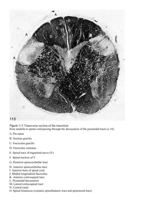 Figure 113 Transverse section of the transition
from medulla to spinal cord passing through the decussation of the pyramidal tracts (x 18)
A. Pia mater
B. Nucleus gracilis
C. Fasciculus gracilis
D. Fasciculus cuneatus
E. Spinal tract of trigeminal nerve (V)
F. Spinal nucleus of V
G. Posterior spinocerebellar tract
H. Anterior spinocerebellar tract
I. Anterior horn of spinal cord
J. Medial longitudinal fasciculus
K. Anterior corticospinal tract
L. Pyramidal decussation
M. Lateral corticospinal tract
N. Central canal
O. Spinal lemniscus (contains spinothalamic tract and spinotectal tract)
 