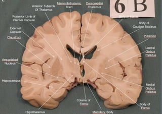 Brain sections - anatomy | PDF