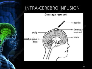 Brain specific delivery | PPTX