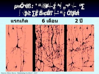 แรกเกิด 6  เดือน 2  ปี ตัวอย่าง : การจัดระเบียบใยประสาท  บริเวณที่เกี่ยวข้องกับการมองเห็น 