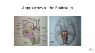 Approaches to the Brainstem
 