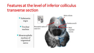 Features at the level of inferior colliculus
transverse section
 